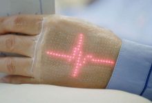 Фото - В НИТУ «МИСиС» работают над робо-рукой, которая будет печатать кожу прямо на пациенте
