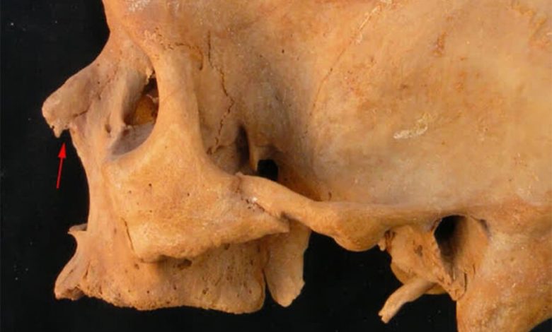 Фото - Археологи обнаружили, что скелету из гробницы пророка бога Амона проломили череп при жизни