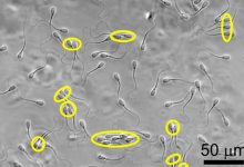 Фото - Биологи обнаружили у сперматозоидов необычную способность