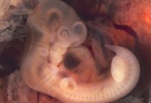 Фото - Ученые выяснили, что рожденные из замороженных эмбрионов дети могут иметь повышенный риск рака