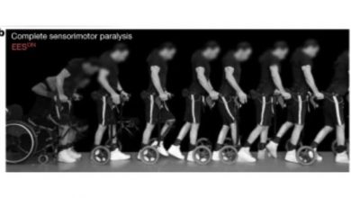 Фото - Nature: электростимуляция спинного мозга вернула парализованным людям способность ходить