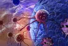 Фото - Онкологи нашли молекулы, блокировка которых может остановить рост раковой опухоли
